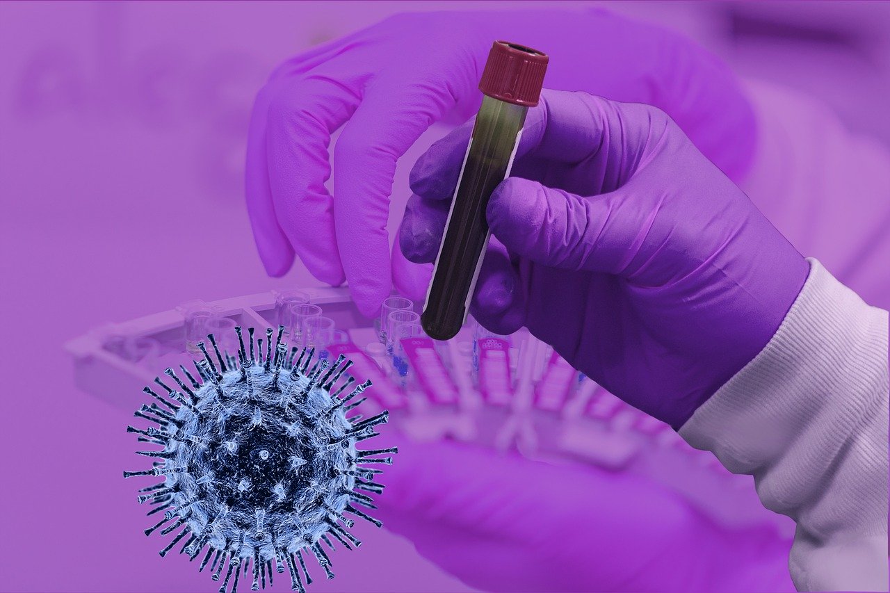 corona virusu testi nerede yapiliyor nasil yapiliyor